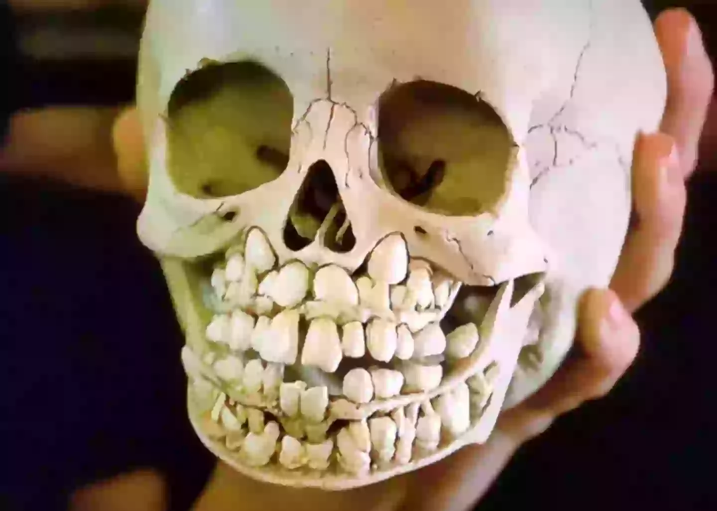Skull