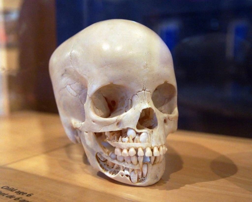 Skull